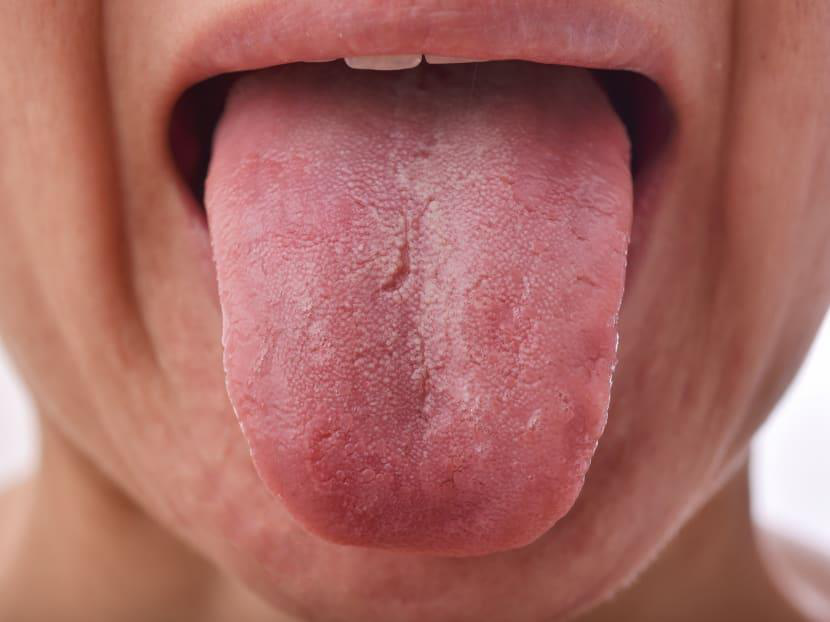 Relație cu carotidă
