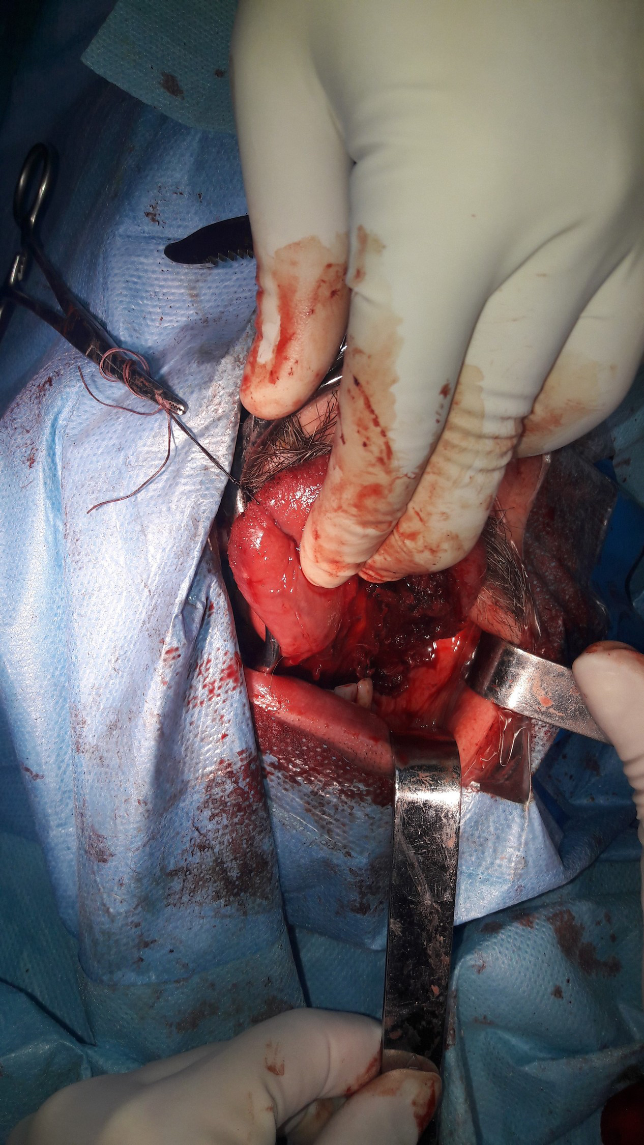 Abord chirurgical limb mobilă