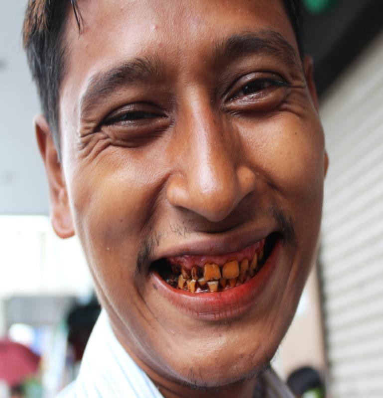 Carcinom jugal