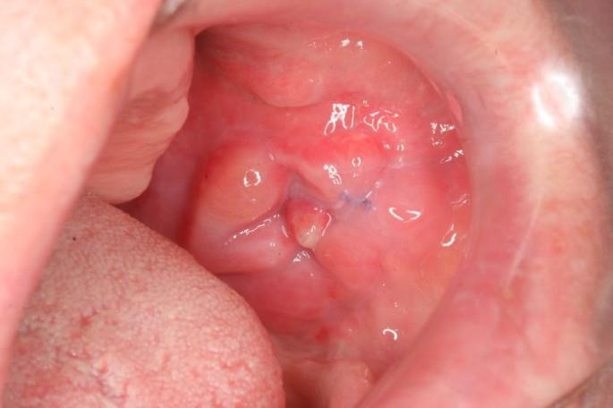 Abord chirurgical