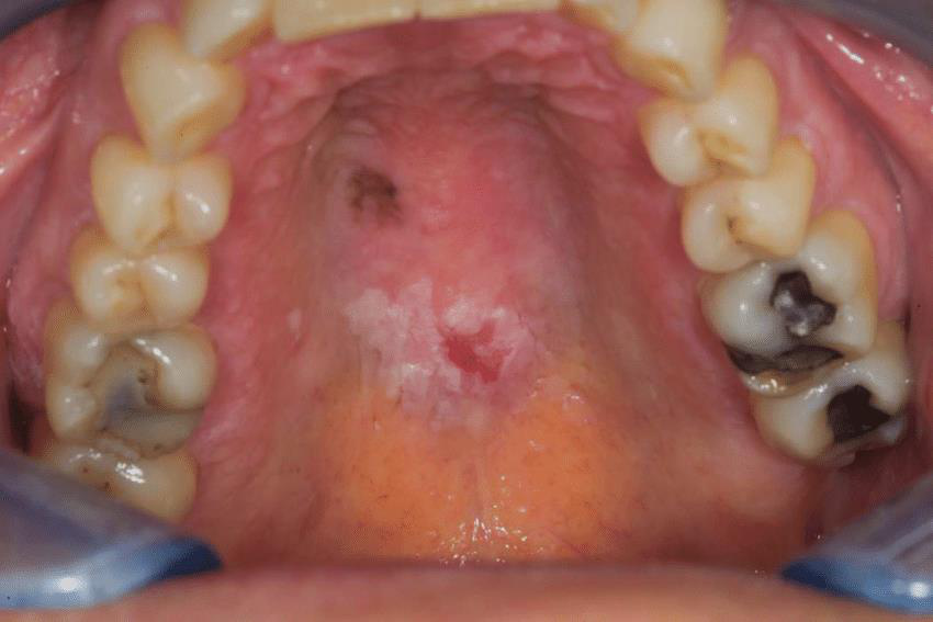 Aspect clinic 3