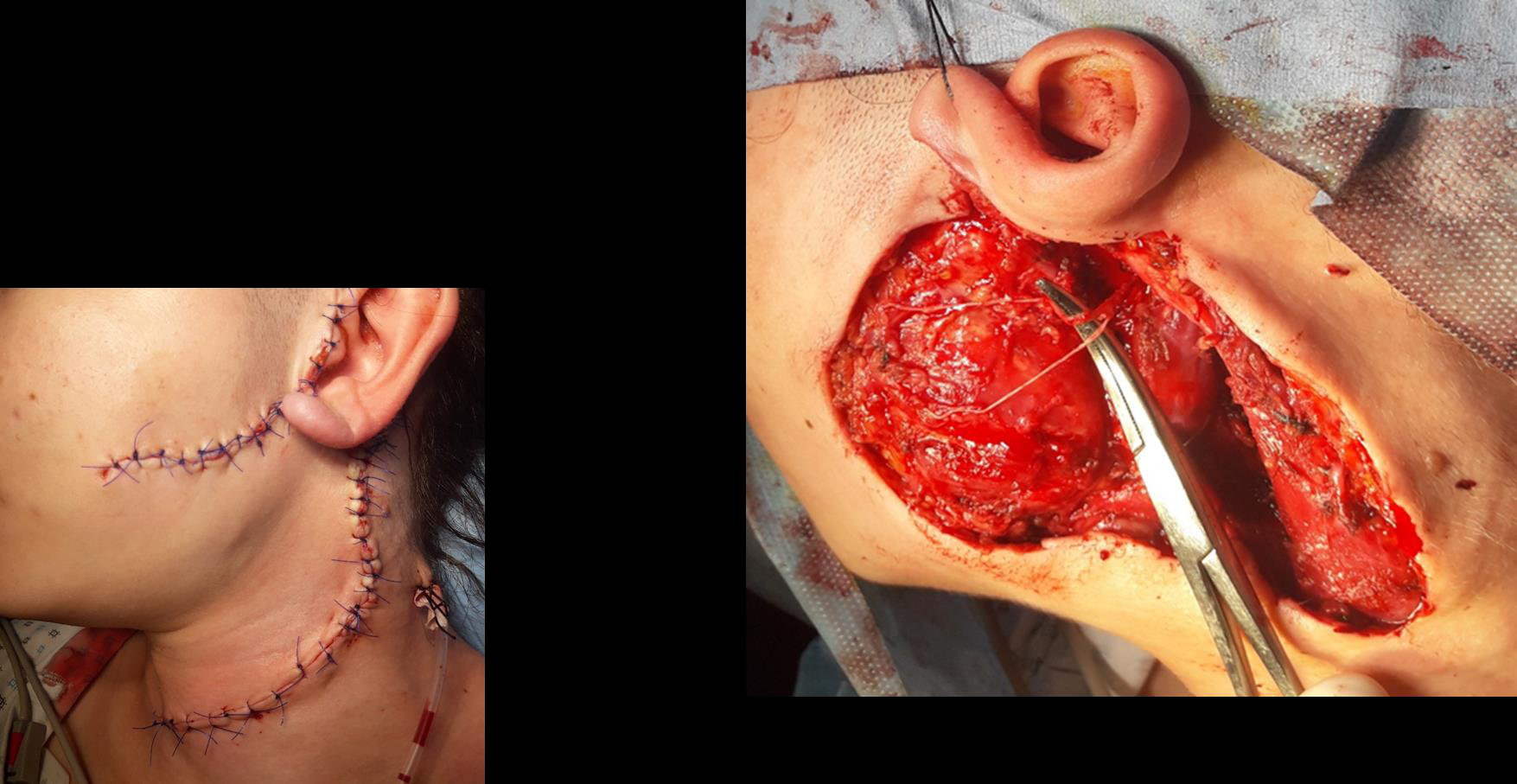 Cervicale