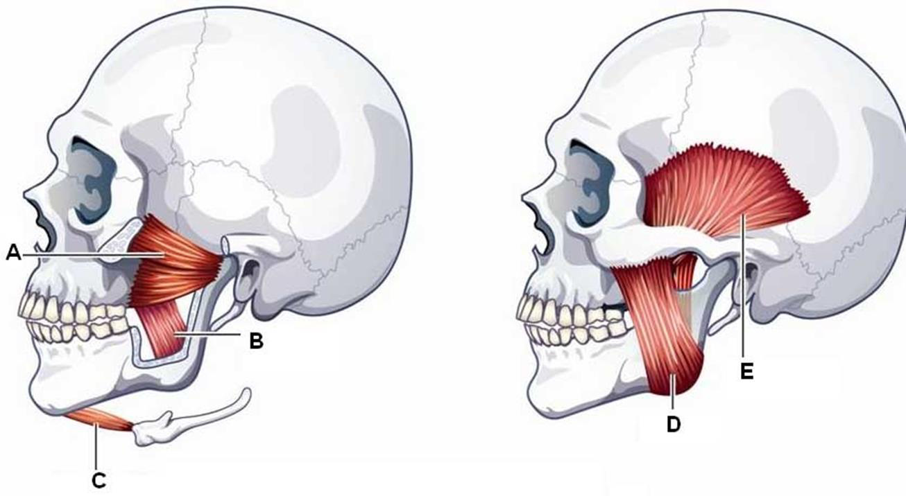 Radiologic hipoplazia